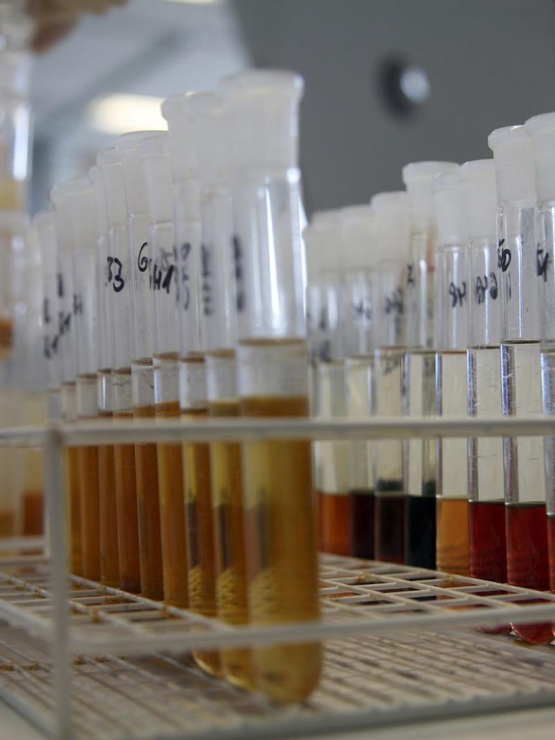 Urine samples on an doping control laboratory
